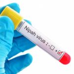 দেশজুড়ে আতঙ্ক ছড়াচ্ছে প্রাণঘাতী নিপাহ ভাইরাস