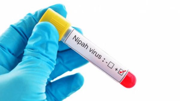 দেশজুড়ে আতঙ্ক ছড়াচ্ছে প্রাণঘাতী নিপাহ ভাইরাস