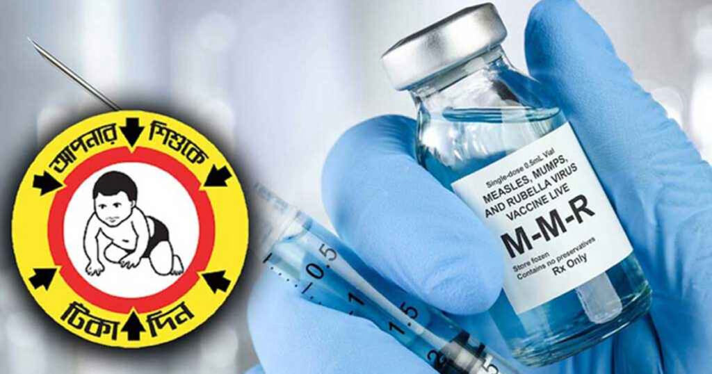 আজ থেকে হামের বিশেষ টিকাদান কর্মসূচি, চলবে যেসব এলাকায়